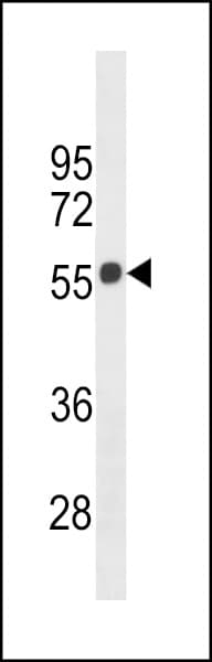 CNR1 / CB1 Antibody (aa161-187)