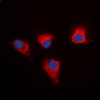 Polyclonal Rabbit anti-Human PEA15 / PEA-15 Antibody (C-Terminus, IHC, IF, WB)