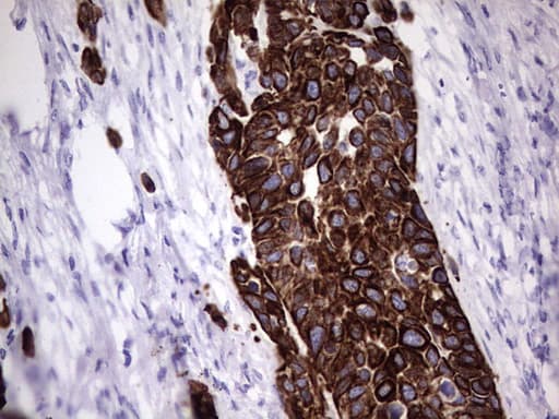 Monoclonal Mouse anti-Human KRT19 / CK19 / Cytokeratin 19 Antibody (clone OTI1F5, aa240-390, IHC, WB)