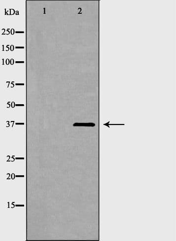Polyclonal Rabbit anti-Human LDHA / LDH1 Antibody (IHC, WB)