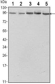 STAT3 Antibody (clone 3B5)
