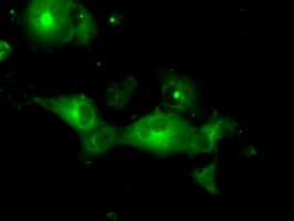 PRKAR2A Antibody (clone OTI5F1)