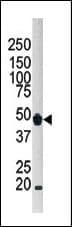 APG4B / ATG4B Antibody (aa358-390)