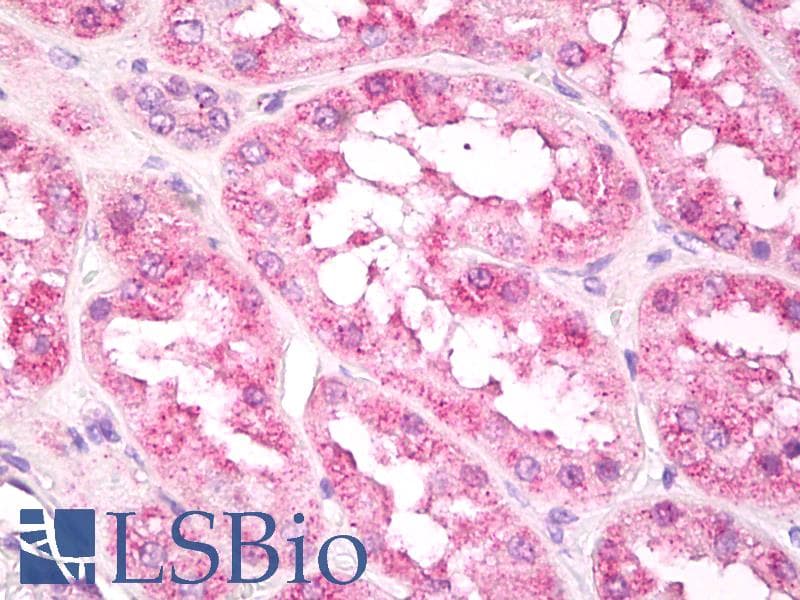 IHC-plus™ EIF3A Antibody (aa550-600)