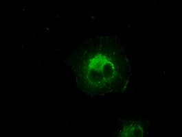 CRYAB / Alpha B Crystallin Antibody (clone OTI6A9)