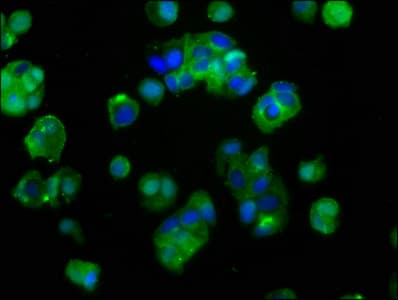 IGF1R / IGF1 Receptor Antibody