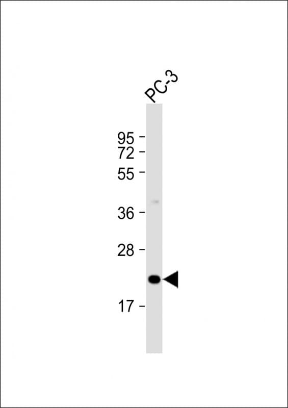 APOBEC3C Antibody (C-Terminus)