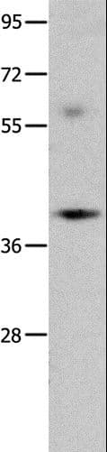 Polyclonal Rabbit anti-Human OPCML / OBCAM Antibody (WB)
