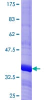 Human LHX6 Protein (Recombinant GST, N-terminus)