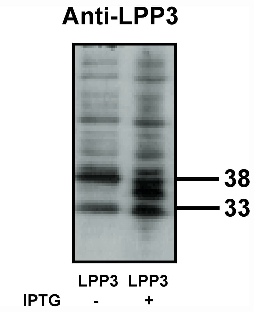IHC-plus™ LPP3 / PPAP2B Antibody