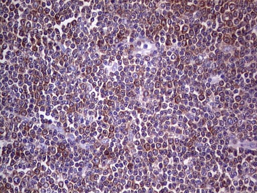 Monoclonal Mouse anti-Human PKM2 Antibody (clone 1F12, IHC, WB)