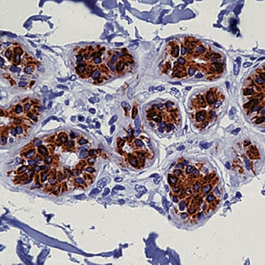 Monoclonal Mouse anti-Human Cytokeratin 8+18 Antibody (clone 5D3, IHC)