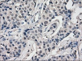 Monoclonal Mouse anti-Human BUB1B / BubR1 Antibody (clone OTI6E5, IHC, IF, WB)
