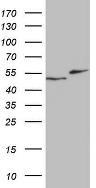 RAD23B / HR23B Antibody (aa1-253, clone OTI13A2)