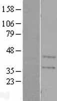 CA11 / Carbonic Anhydrase XI Protein (Over-Expression Lysate Myc-DDK (Flag))