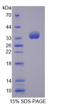 Mouse TBCB / CKAP1 Protein (Recombinant His, N-Terminal)