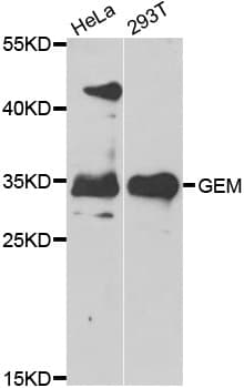 GEM / KIR Antibody