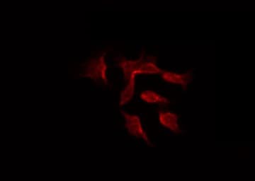 DGKeta / DGKH Antibody
