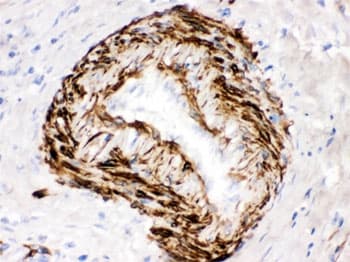 Polyclonal Rabbit anti-Human SMYD3 Antibody (IHC, WB)