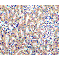 TRAIL-R4 / DCR2 Antibody