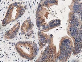 OSBP Antibody (clone OTI1F2)