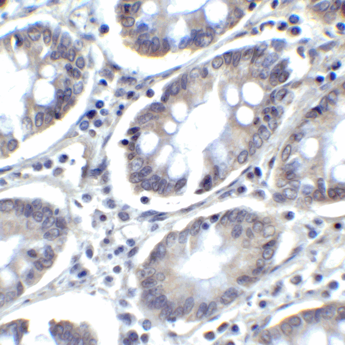 IHC-plus™ Monoclonal Mouse anti-Human PD-L2 / PDCD1LG2 / CD273 Antibody (clone 7C7, IHC, IF, WB)