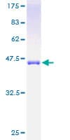 Human SRI / Sorcin Protein (Recombinant GST)