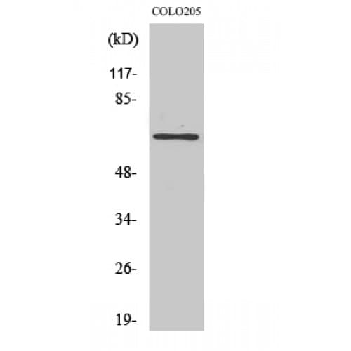 TUBGCP4 Antibody (160-240 aa, Internal)