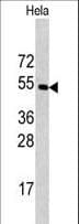CPE / Carboxypeptidase E Antibody (aa381-412)