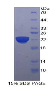 Human PIK3CB / PI3K Beta Protein (Recombinant His)