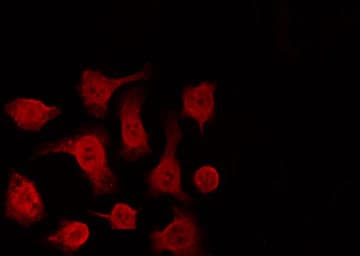 Polyclonal Rabbit anti-Human TP63 / p63 Antibody (IF, WB)