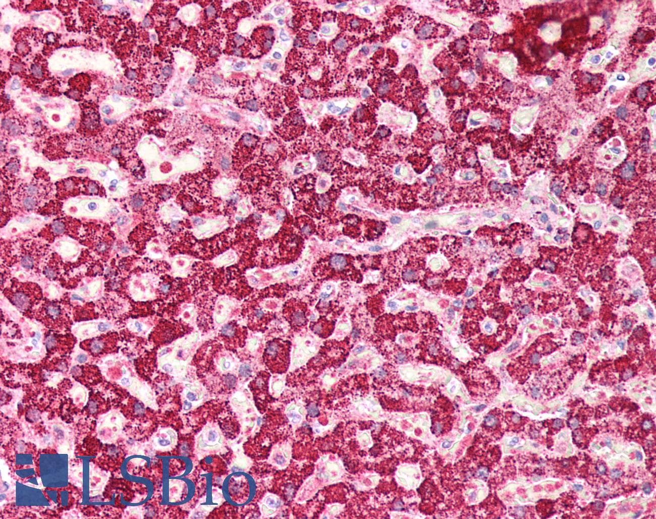 IHC-plus™ Polyclonal Rabbit anti-Human LAP3 Antibody (IHC, WB)