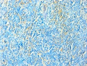 Polyclonal Rabbit anti-Human TFEB Antibody (aa1-220, IHC, WB)