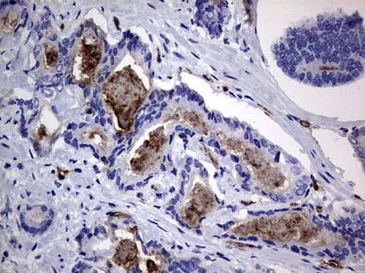 CEACAM5 / CD66e Antibody (aa35-680, clone OTI1C2)