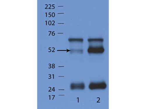 GTPase Activating Protein (GAP) Antibody (N-Terminus)
