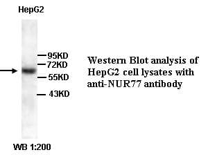 Polyclonal Rabbit anti-Human NR4A1 / NUR77 Antibody (Internal, IHC, WB)