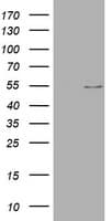 Vimentin Antibody (aa210-466, clone OTI7F5, Carrier-free)