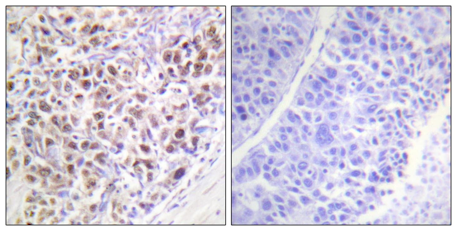 AURKB / Aurora-B Antibody (phospho-Thr232)