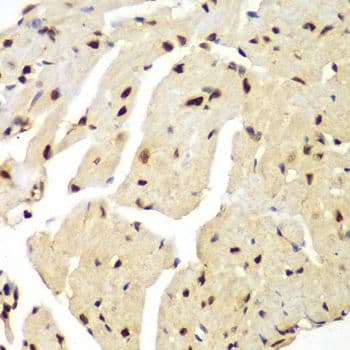LIG3 / DNA Ligase III Antibody