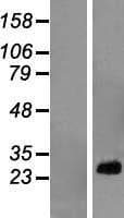 RPL10A Protein (Over-Expression Lysate Myc-DDK (Flag))
