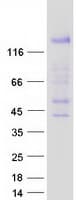 Human TSHZ3 Protein (Recombinant Myc-DDK (Flag))