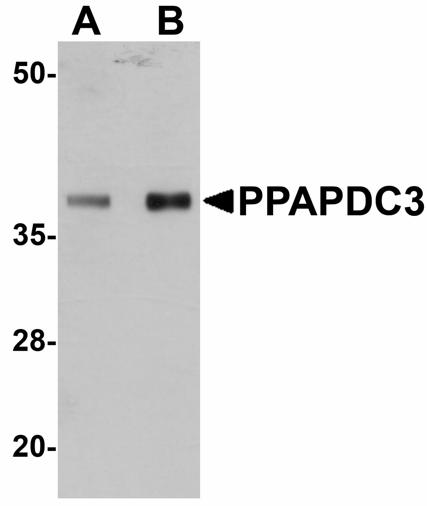 IHC-plus™ PPAPDC3 Antibody