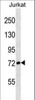 Polyclonal Rabbit anti-Human Apg7 / ATG7 Antibody (aa22-51, IHC, WB)