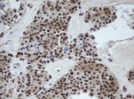 Cullin 4B / CUL4B Antibody (clone OTI1C4)