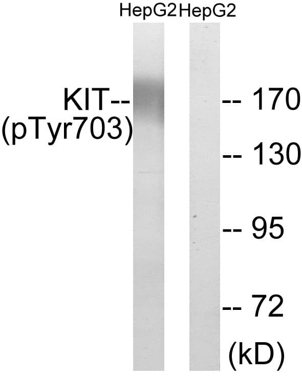 c-Kit / CD117 Antibody (phospho-Tyr703)