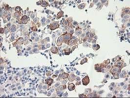 HCA557B / METTL21A Antibody (clone OTI2G7)