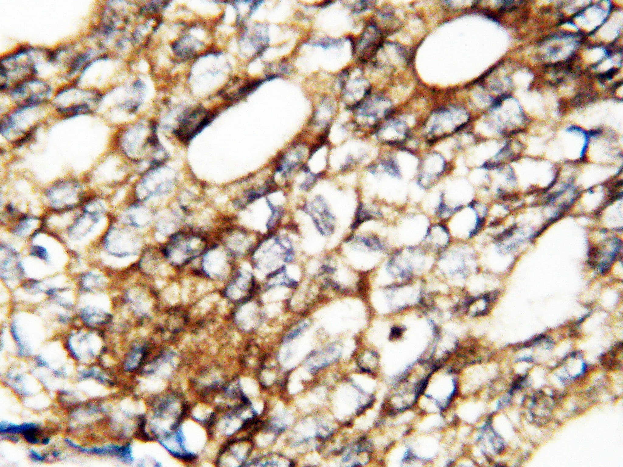 FGF1 / Acidic FGF Antibody (aa16-155)