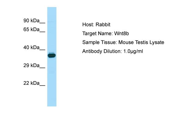 Polyclonal Rabbit anti-Mouse WNT8B / Wnt 8b Antibody (aa251-300, WB)