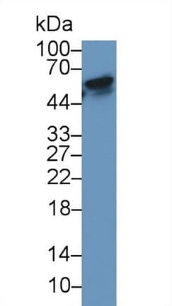 TNFRSF11A / RANK Antibody