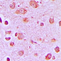 Polyclonal Rabbit anti-Human SYT1 / Synaptotagmin Antibody (Internal, IHC, WB)